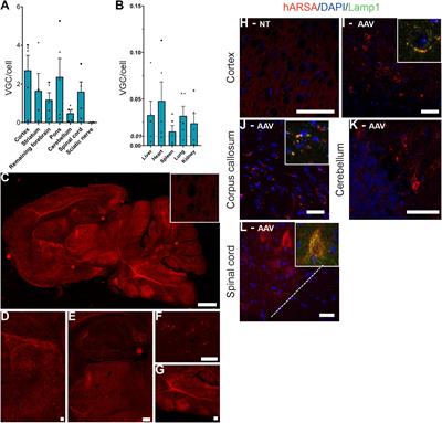 Complete Correction of Brain and Spinal Cord Pathology in Metachromatic Leukodystrophy Mice